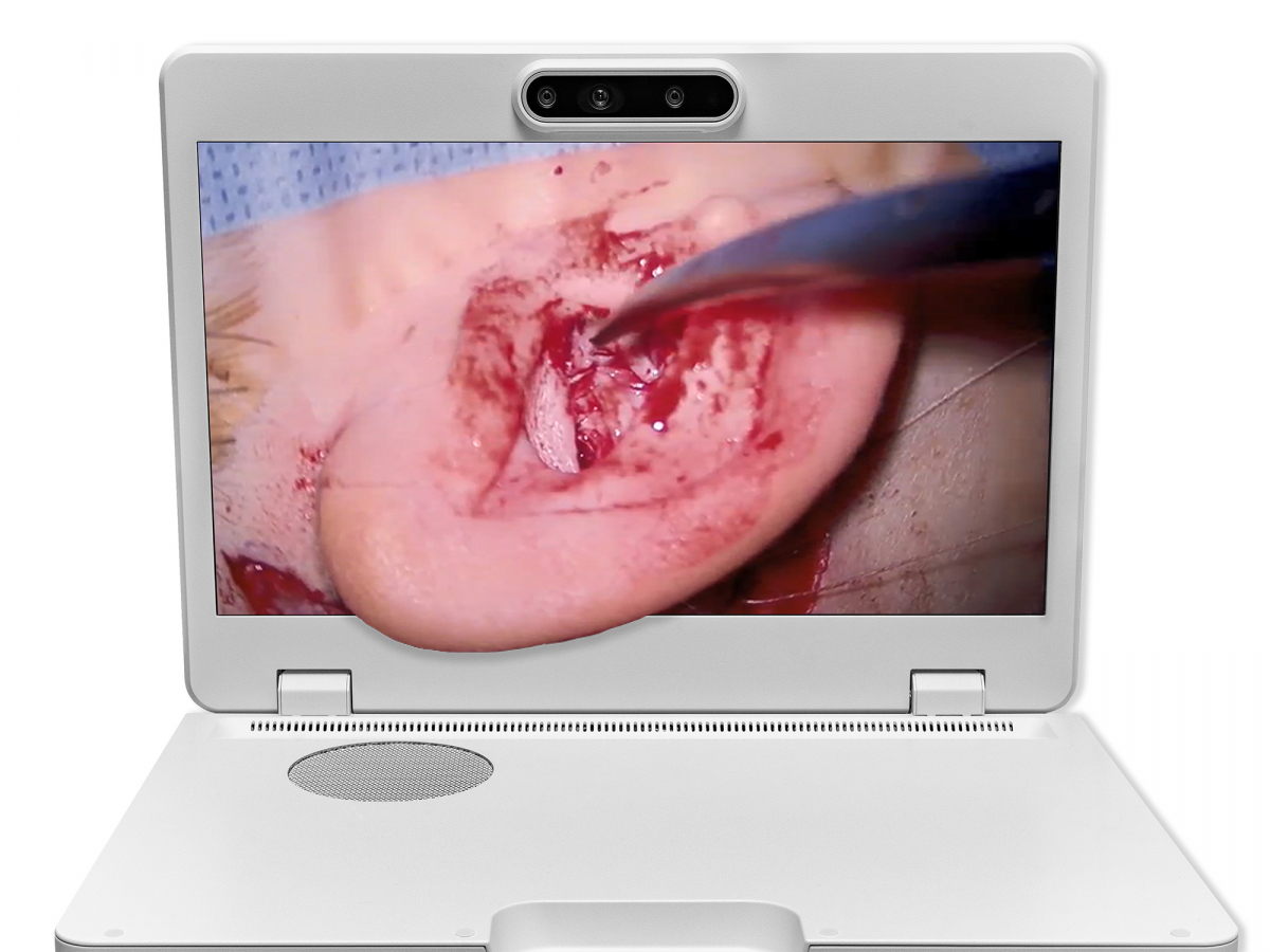 ADP&rsquo;s Heads-up 3D Imaging Display System for Microsurgery integrates 4K glasses-free 3D display and an eye-tracking system, which quickly tracks the position of the human eye. It reduces the burden of physicians of extended periods under fixed postures, and provides a broader, and clearer 3D stereoscopic image under a more comfortable position.